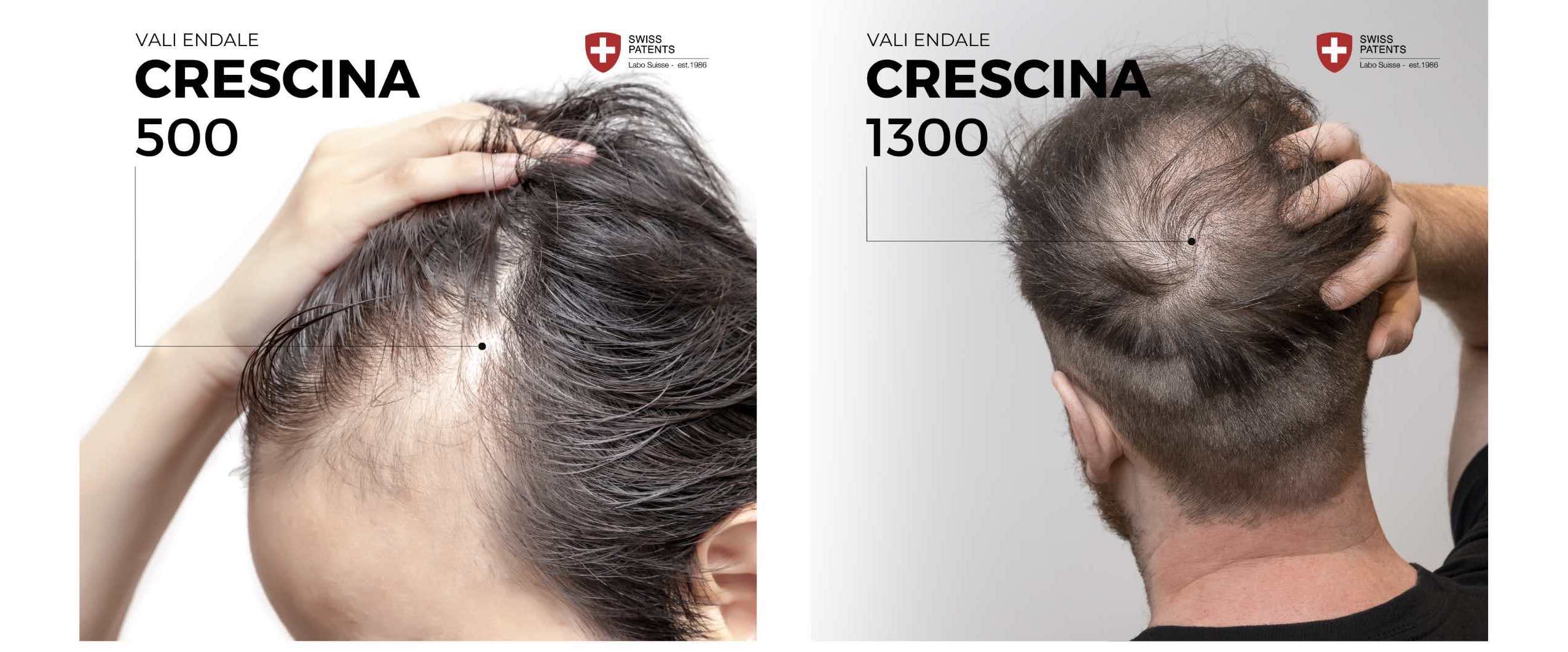 crescina 500 1300 meestele