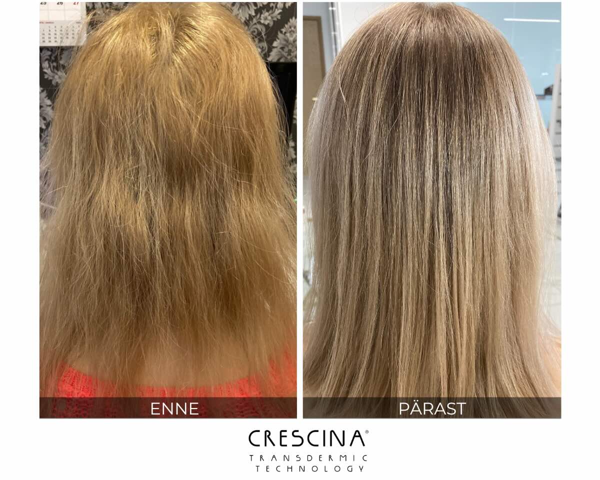 tihedamad-juuksed-crescina-enne-parast.jpg