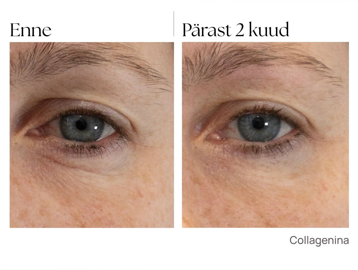 enne_parast_collagenina_seerum_kollageeniga